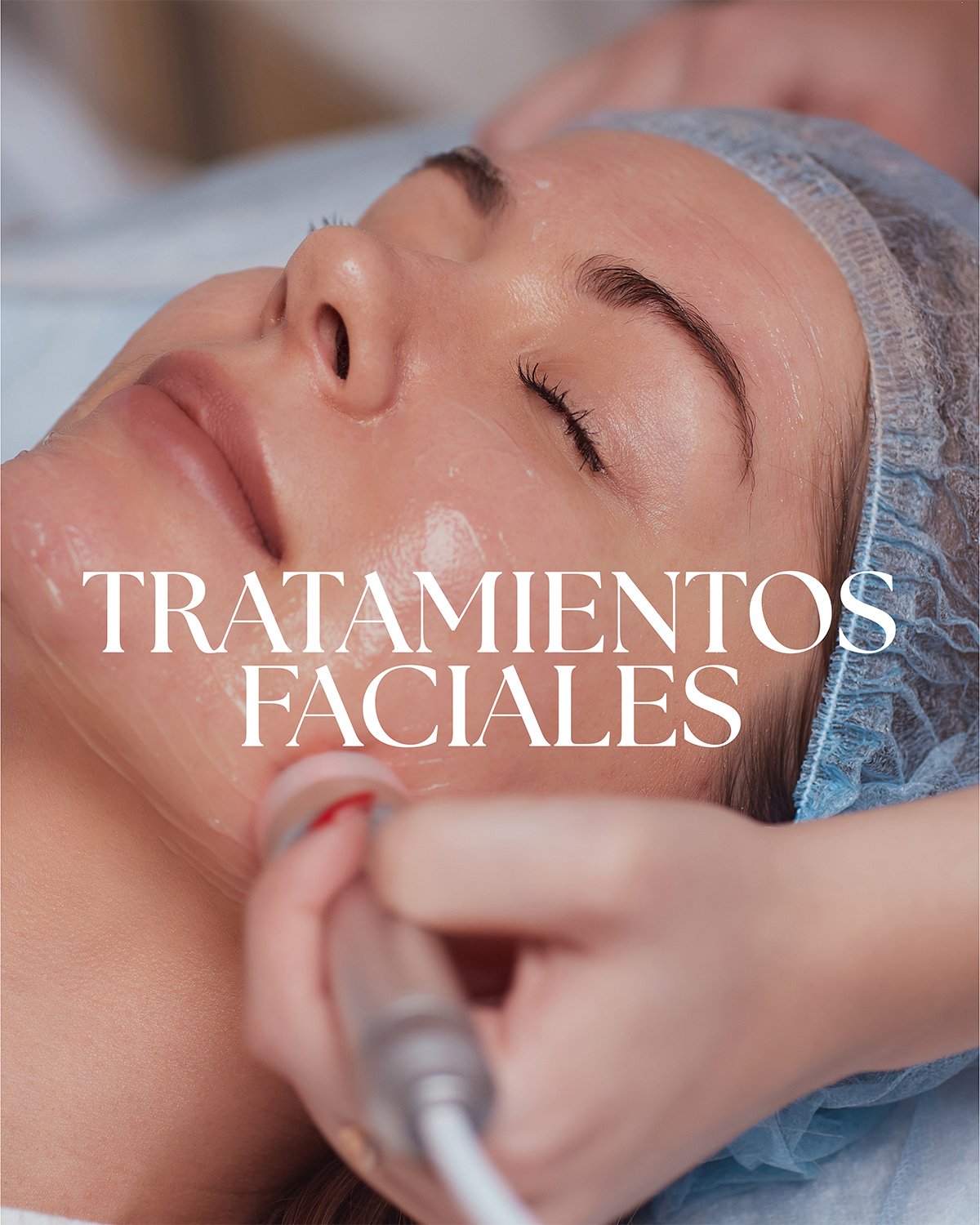 Tratamientos de rejuvenecimiento facial