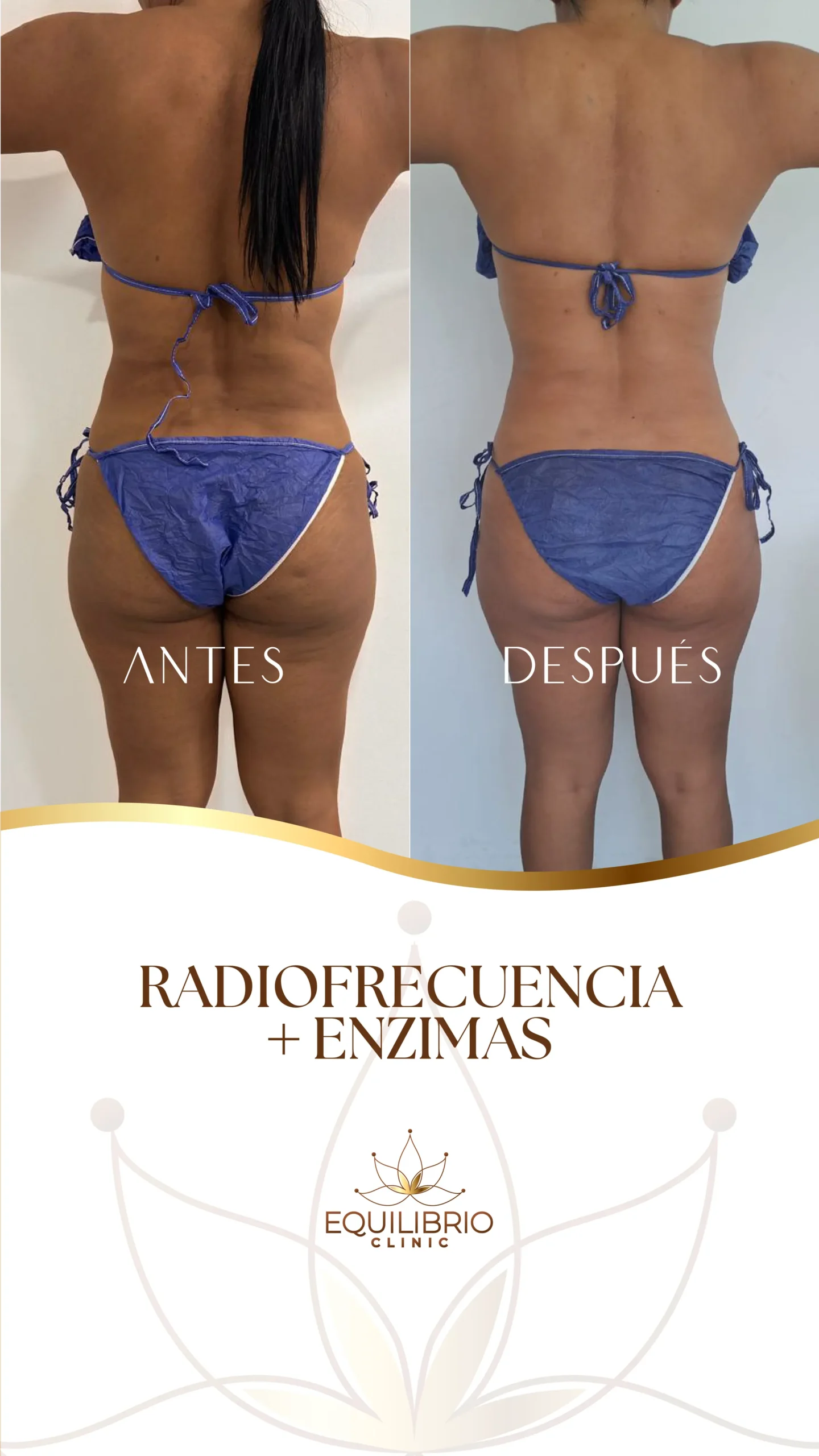 Resultado de moldeamiento corporal 3